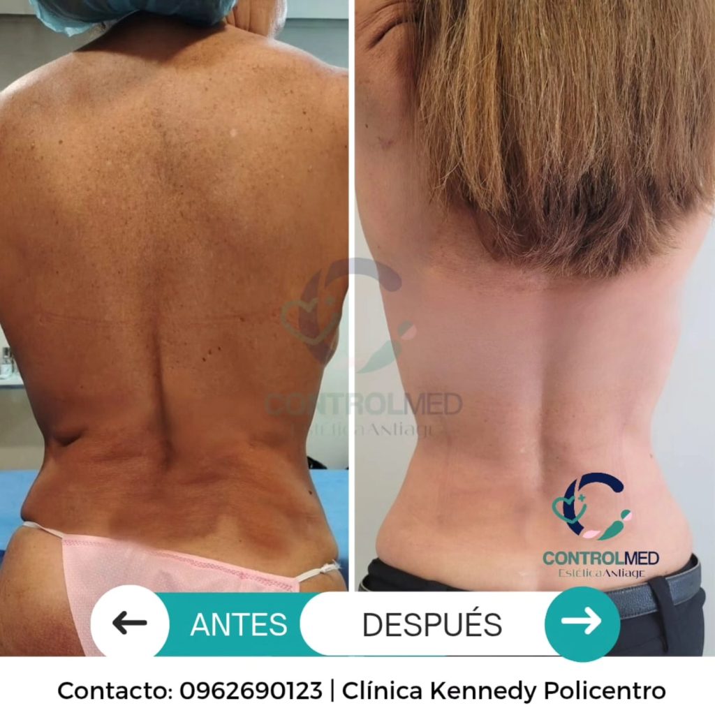 cinturacontrolmed