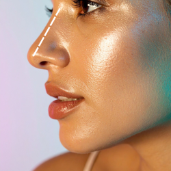 RINOMODELACIÓN O DORSO DE LA NARIZ