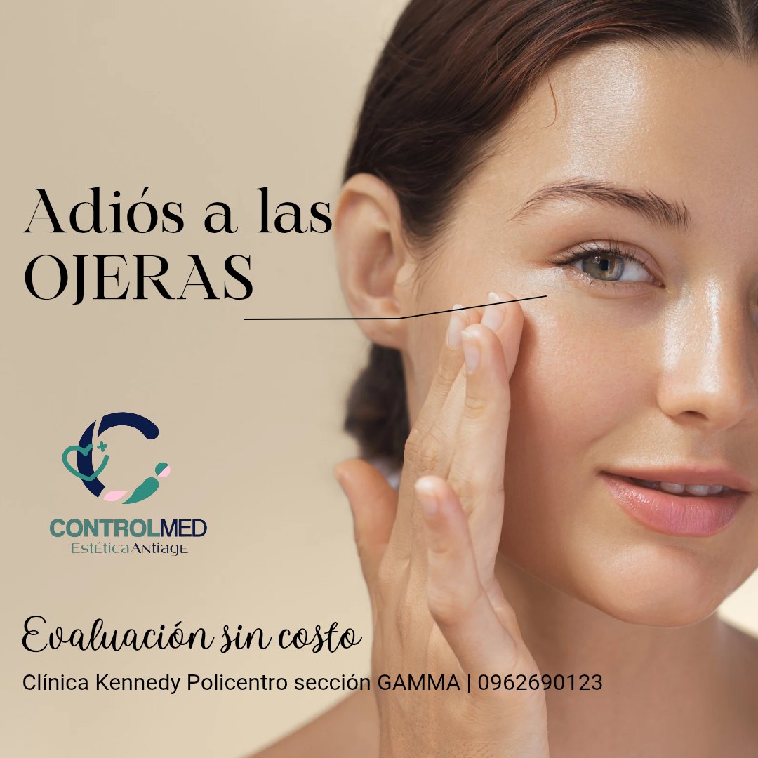 CORRECIÓN DE OJERAS - Imagen 2