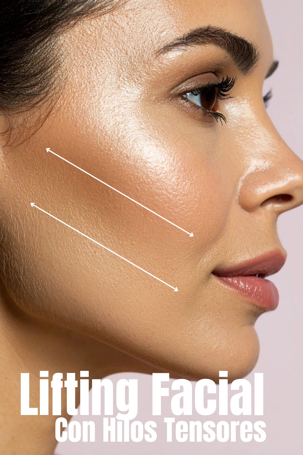 LIFTING FACIAL CON HILOS TENSORES